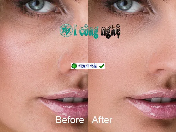 Skinfiner